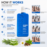 Amazon Protein Anti Dandruff Shampoo 350 ml | Soothes Dry Scalp | Reduces Flakes & Itchiness | Protein-Enriched Formula | For All Hair Types | Anti-Pelliculaire Shampoo