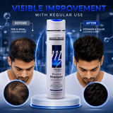 Biotin Shampoo Sulphate Free 300ml | Professional Hair Treatment | Strengthens Hair & Reduces Hair Fall | For Men & Women, All Hair Types
