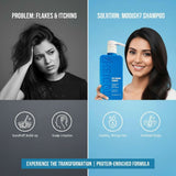 Amazon Protein Anti Dandruff Shampoo 350 ml | Soothes Dry Scalp | Reduces Flakes & Itchiness | Protein-Enriched Formula | For All Hair Types | Anti-Pelliculaire Shampoo